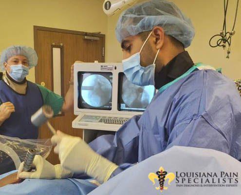 Sacroiliac (SI) Joint Fusion