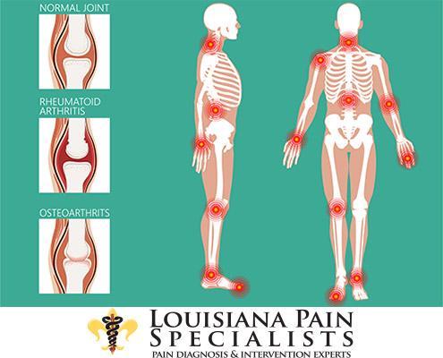 What Is Arthritis?