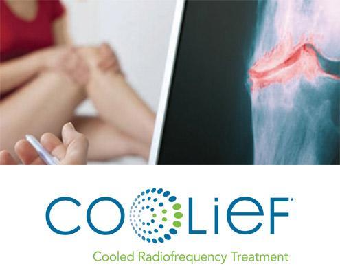 COOLIEF – Non-Surgical Treatment For Relief of Chronic Back Pain