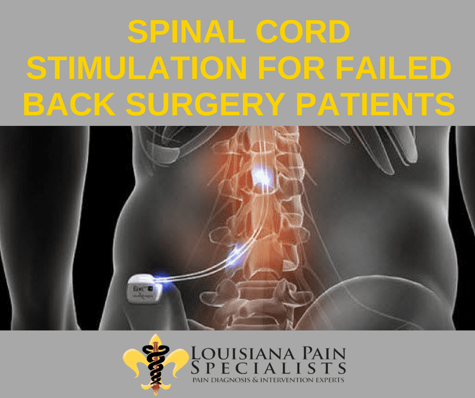 Spinal Cord Stimulation For Failed Back Surgery Patients