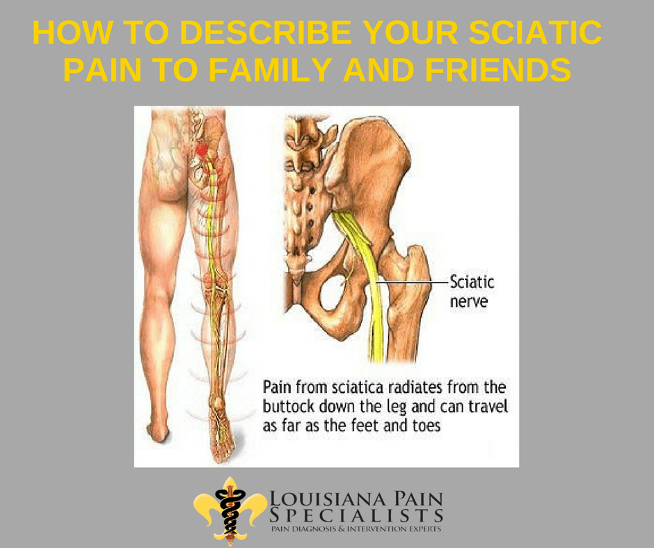 What Is Sciatica And How Is It Treated?