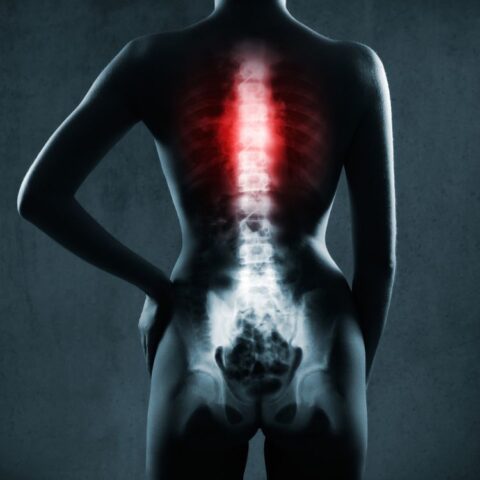 Discogram | Louisiana Pain Specialists